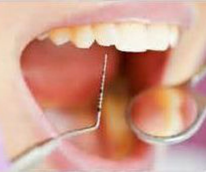 PERIODONCIA: ESPECIALIDADES de Clínica Dental Morey