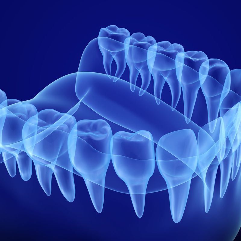 Radiología Digital: Nuestros Servicios de Bonestar Clínica Dental