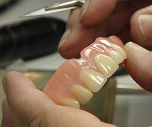 Por qué apostar por la implantología dental