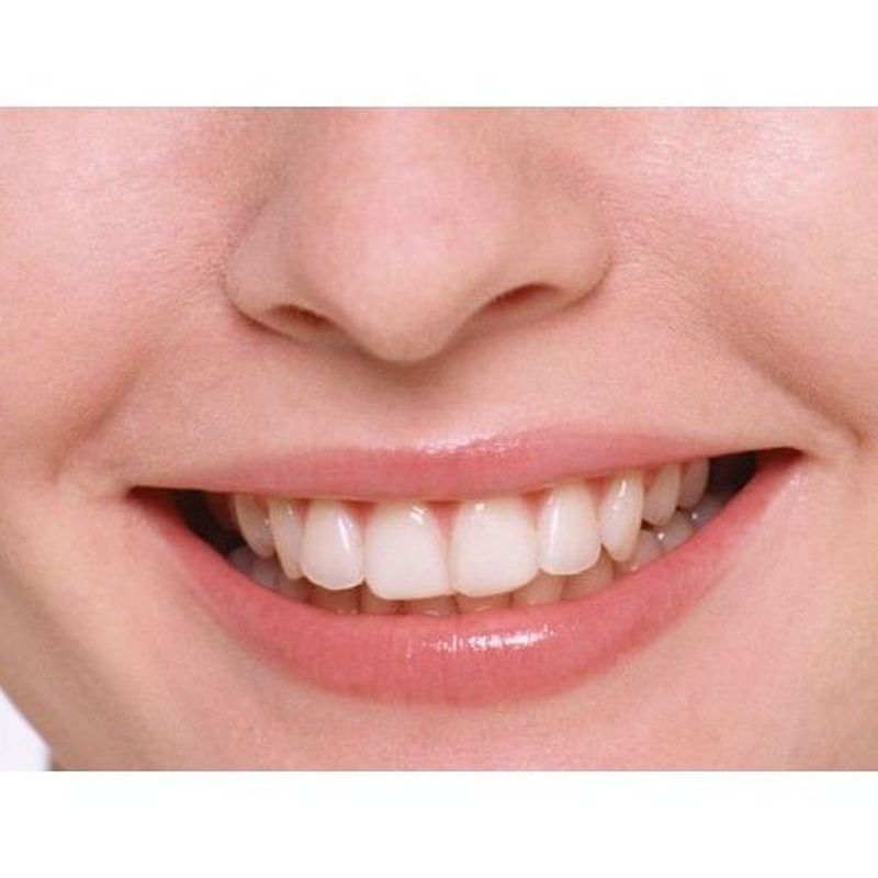 Estética dental: Tratamientos dentales de MARÍA JOSÉ CLOLS FERRER