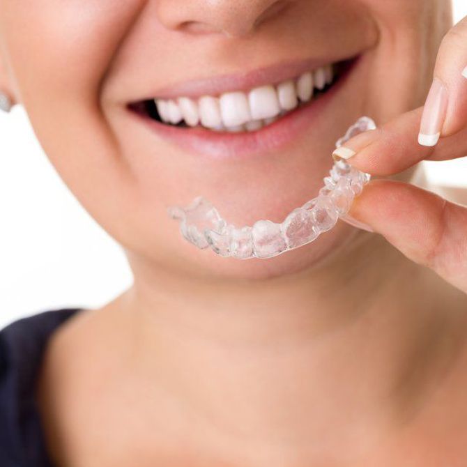¿Qué tipos de tratamiento de ortodoncia son los más comunes hoy en día?