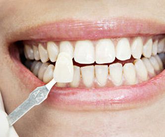Ortodoncia: Tratamientos de Abando Hortz Klinika