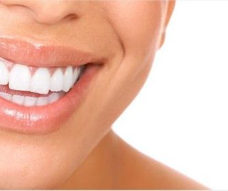 Blanqueamiento dental: Tratamientos de Dental Icaria, S.L.