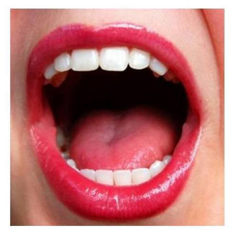 Estética: Tratamientos de Lasierra Fondevila Clínica Dental