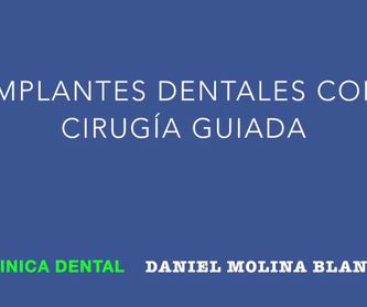 Cirugía guiada por ordenador: Tratamientos y tecnología de Clínica Dental Daniel Molina
