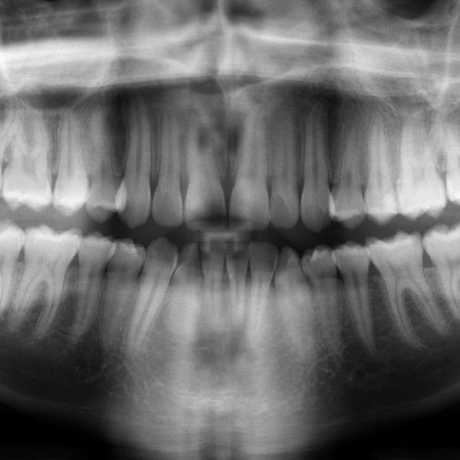 Tipos de radiografías dentales