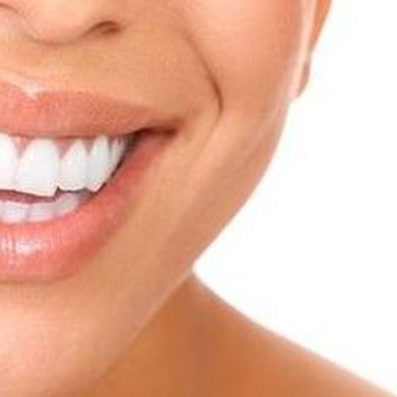 Ortodoncia: Especialidades de Clínica Dental Martín