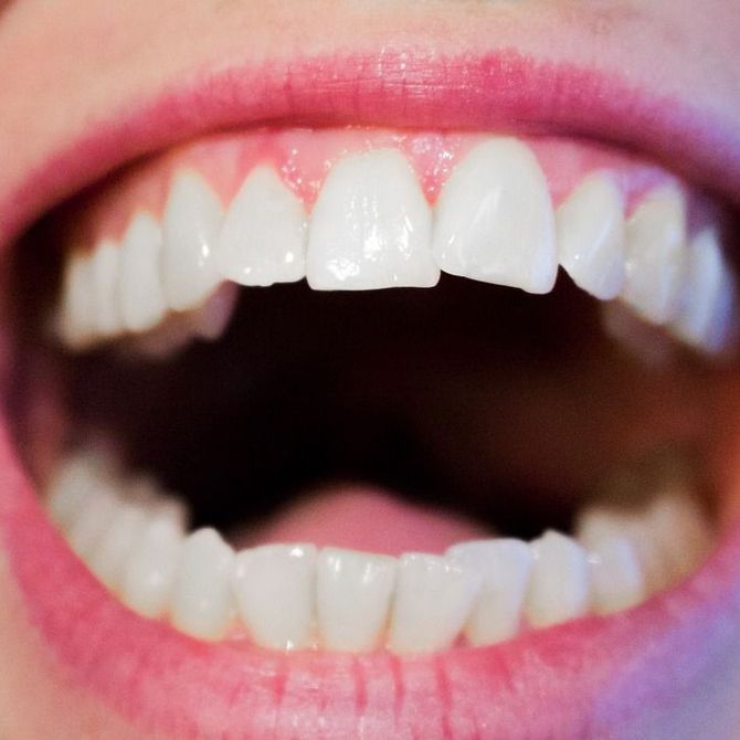 La mejor forma de cuidar los implantes dentales