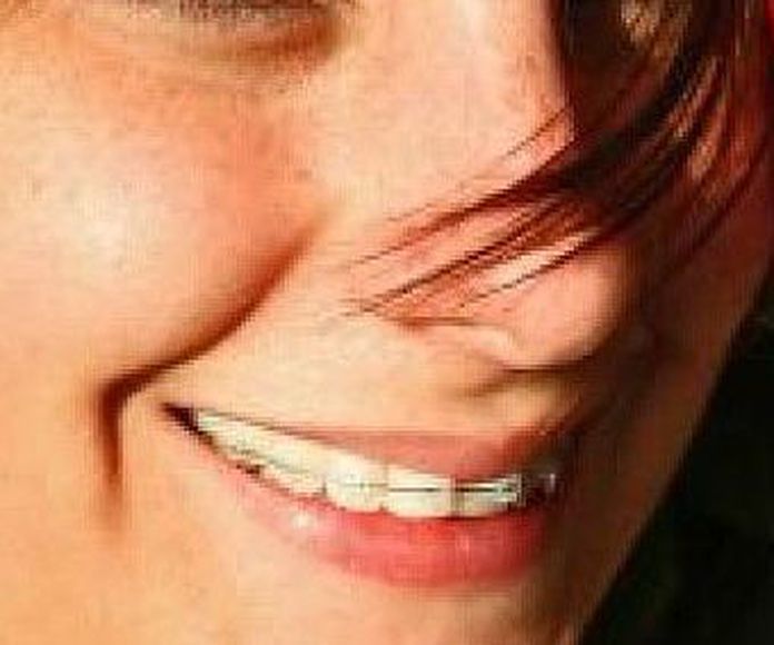 Ortodoncia: Servicios de Clínica Dental Alodent