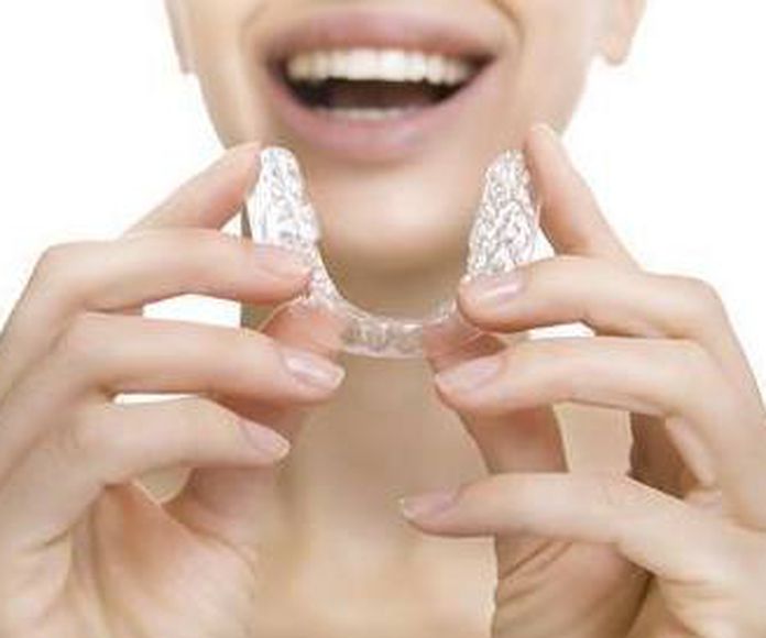 Te damos 5 consejos de higiene para tu ortodoncia removible. }}
