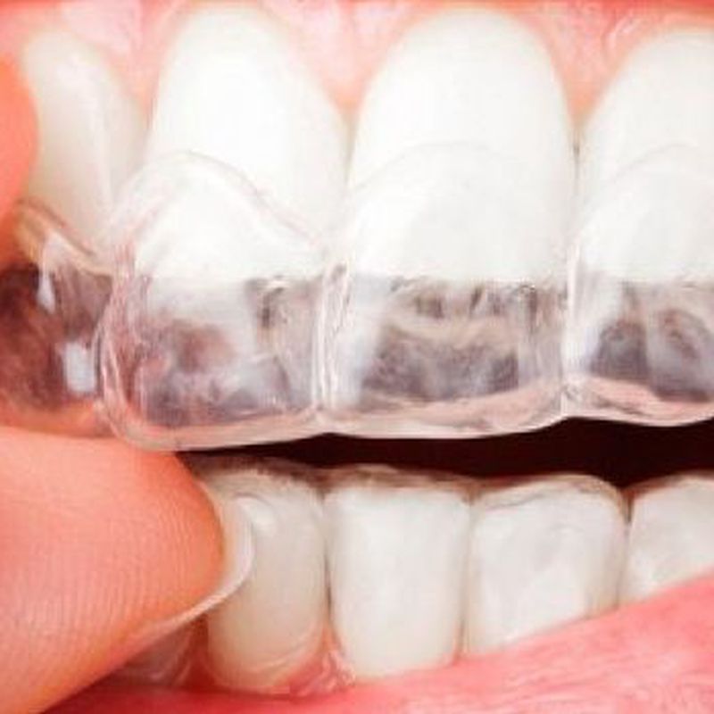 Ortodoncia invisible: Tratamientos dentales de Clínica Dental Dres. Nuñez García