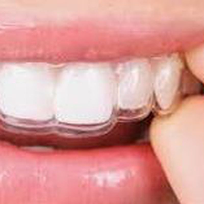 Ortodoncia invisible: Tratamientos dentales de Clínica Dental Dres. Nuñez García
