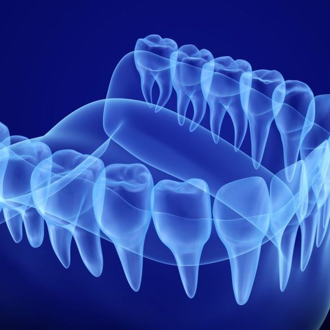 Las radiografía dentales, un elemento diagnóstico imprescindible