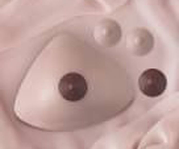 Mastectomia