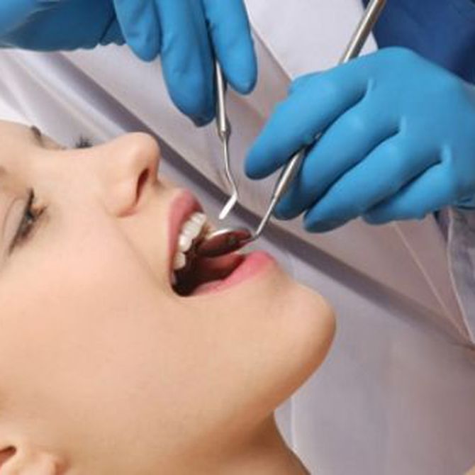 ¿Cómo realizo el mantenimiento de mis implantes dentales?