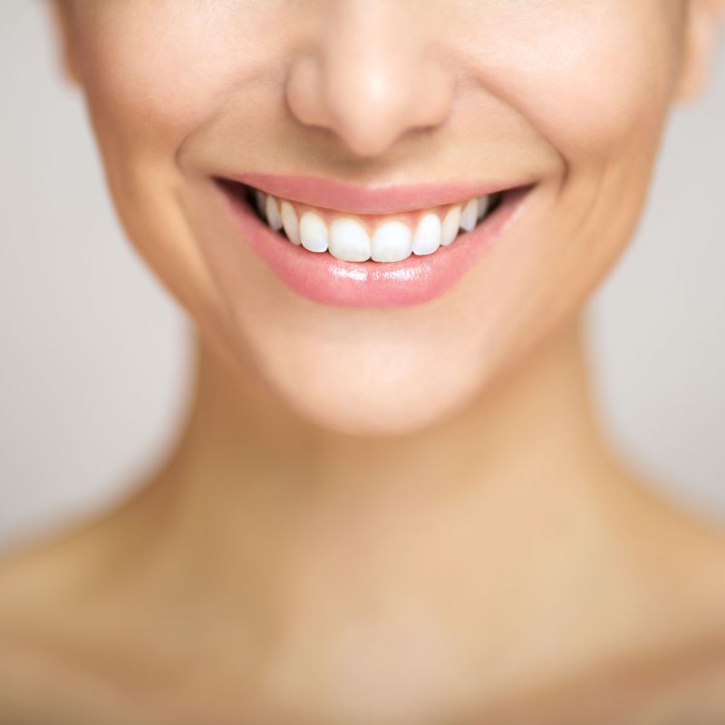 Estética dental: Servicios de Clínica Dental Dra. Amparo Magraner