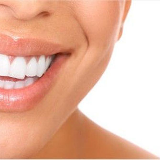 ¿En qué consiste la ortodoncia invisible?