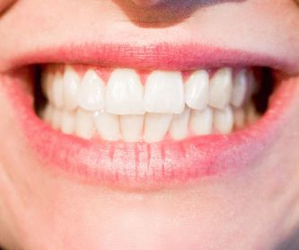 Ortodoncia: Servicios de Clínica Dental Dra. Esther Blánquez