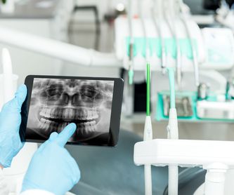 Implantología: Diagnóstico y prevención de Clínica Dental Doctoras Álvarez y Frutos