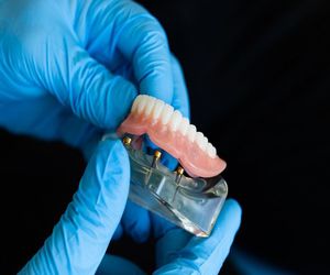 ¿Cómo cuidar tu prótesis dental?