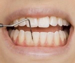 Periodoncia