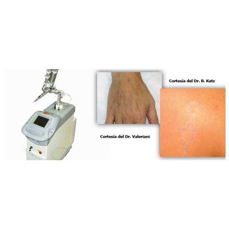 Láser Q-Switched: Servicios y tratamientos de Dr. Aliaga Clínica Dermatológica