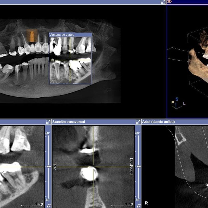 radiología digital 3 D en MILLADOIRO