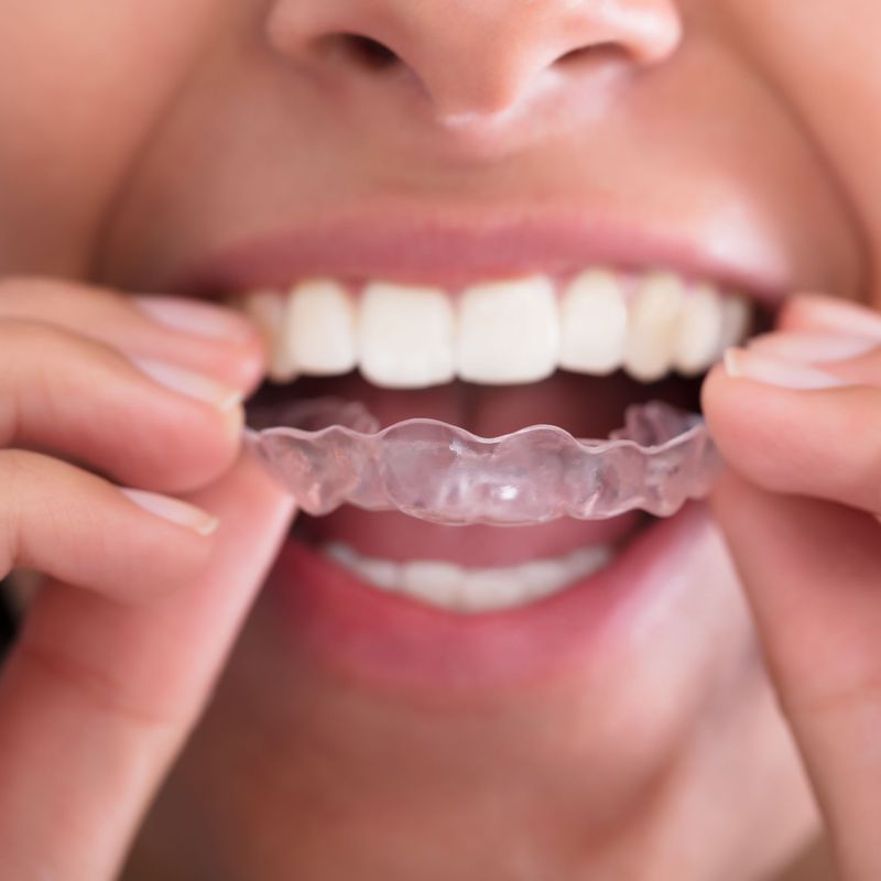 Ortodoncia: Tratamientos de Clínica Dental Santa Marta
