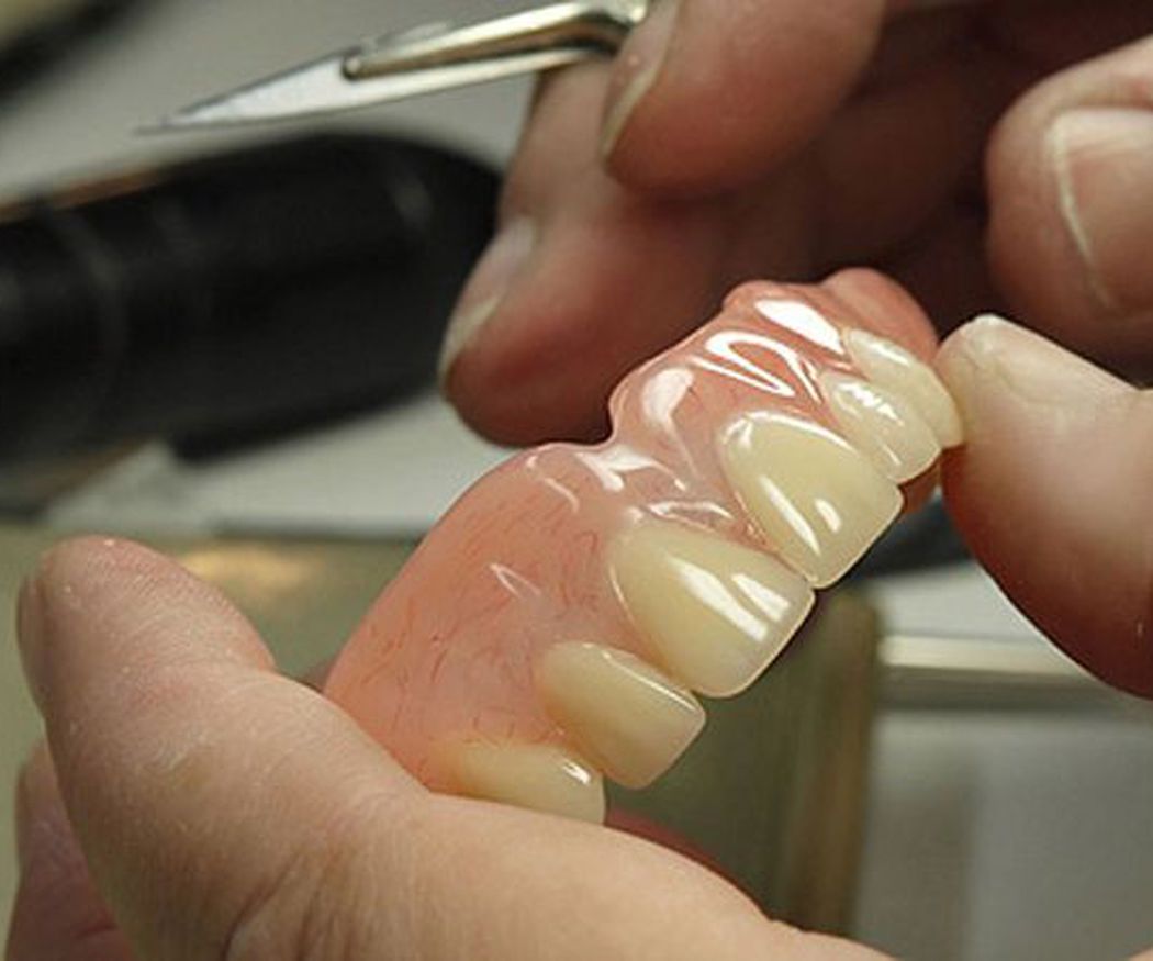 Las prótesis dentales
