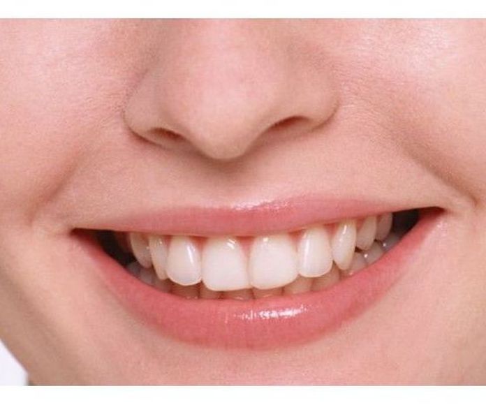 Estética dental: Tratamientos de Clínica Dental Xixón