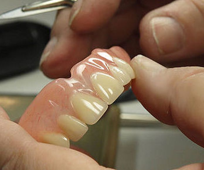 Prótesis fija: Servicios de Clínica Dental Gándara