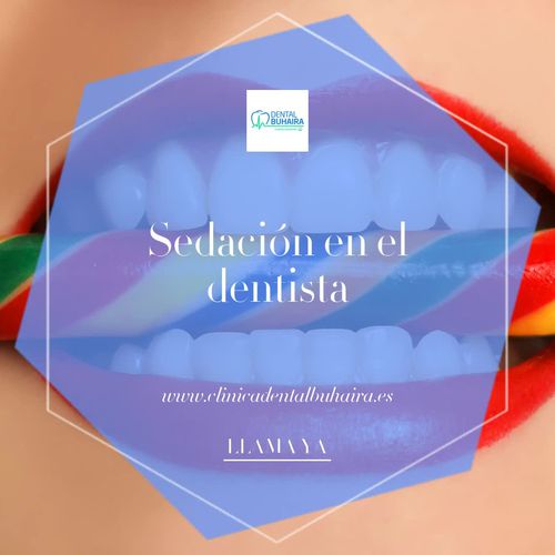 Implantes dentales en Sevilla | Clínica Dental Buhaira