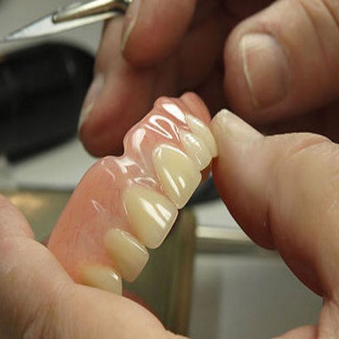 Ventajas de las prótesis dentales removibles