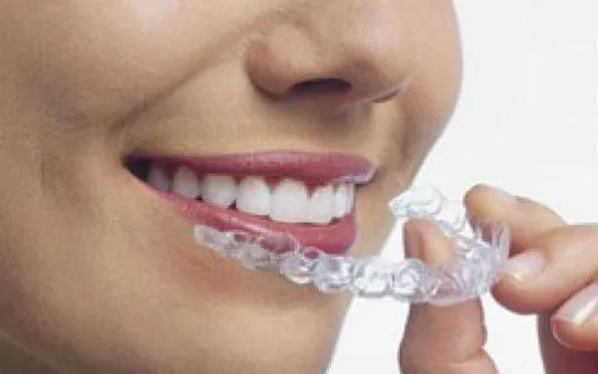 Ortodoncia estética