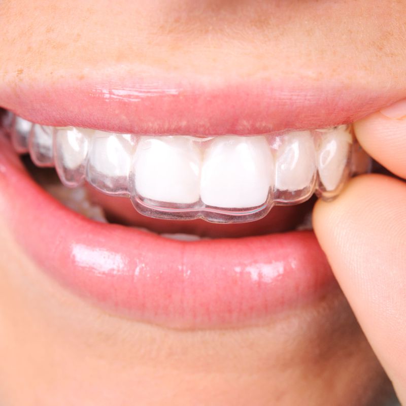 Ortodoncia invisible: Tratamientos dentales de Garrido Palacios, Mª Cruz