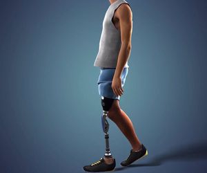 PRIMERA ORTOPEDIA EN ESPAÑA EN IMPLANTAR UN PIE RUSH