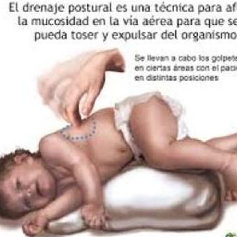 Fisioterapia respìratoria en un bebé