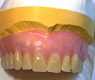 Casos clínicos: Tratamientos de Clínica Dental Dr. de la Torre