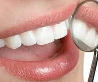 Tac dental: Servicios de Clínica Dental Dra. Esther Blánquez