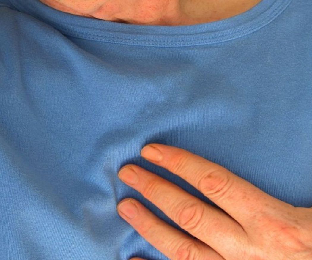 ¿Qué es un infarto y cuáles son sus síntomas?