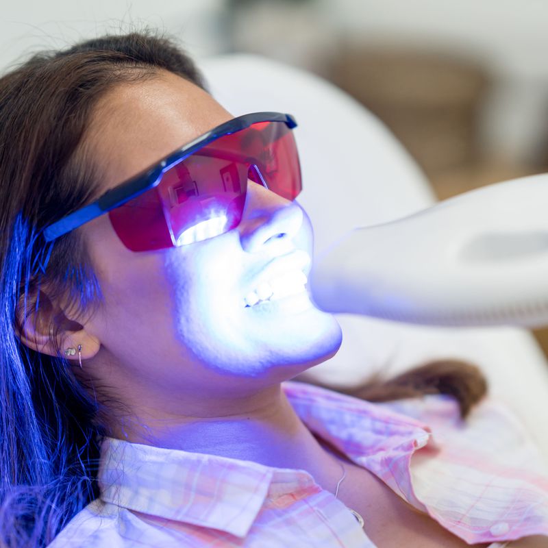 Blanqueamientos Dentales: Servicios de Clinica Dental Garó