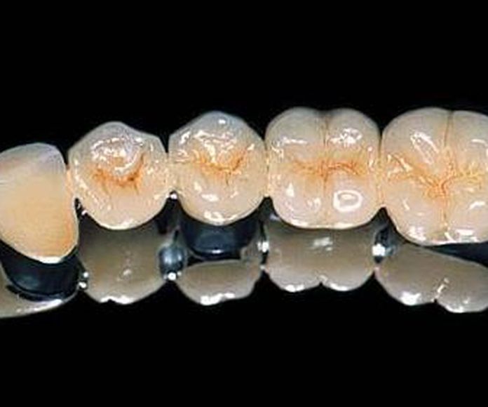 protesis de alumina
