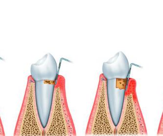 Odontología restauradora: Tratamientos de Centro Dental Europa