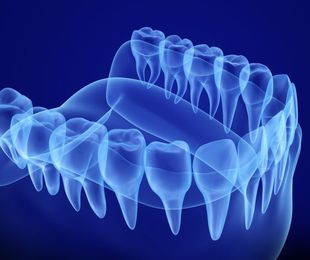 Las radiografía dentales, un elemento diagnóstico imprescindible
