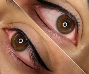 Eyeliner micropigmentacion