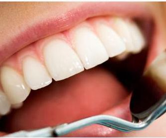 Odontología General: Servicios de Clínica Dental Safident
