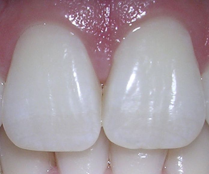 Estética dental: Servicios de Clínica Dental Alodent