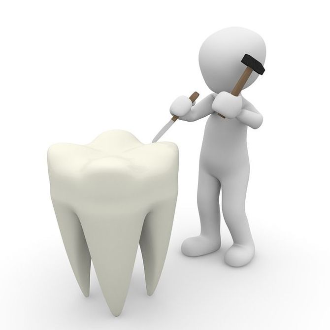 ¿Qué es una periodoncia?