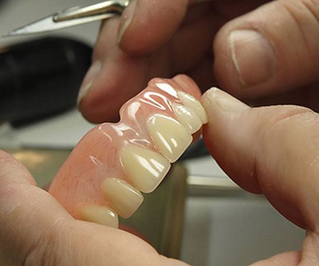 Mitos de las prótesis dentales