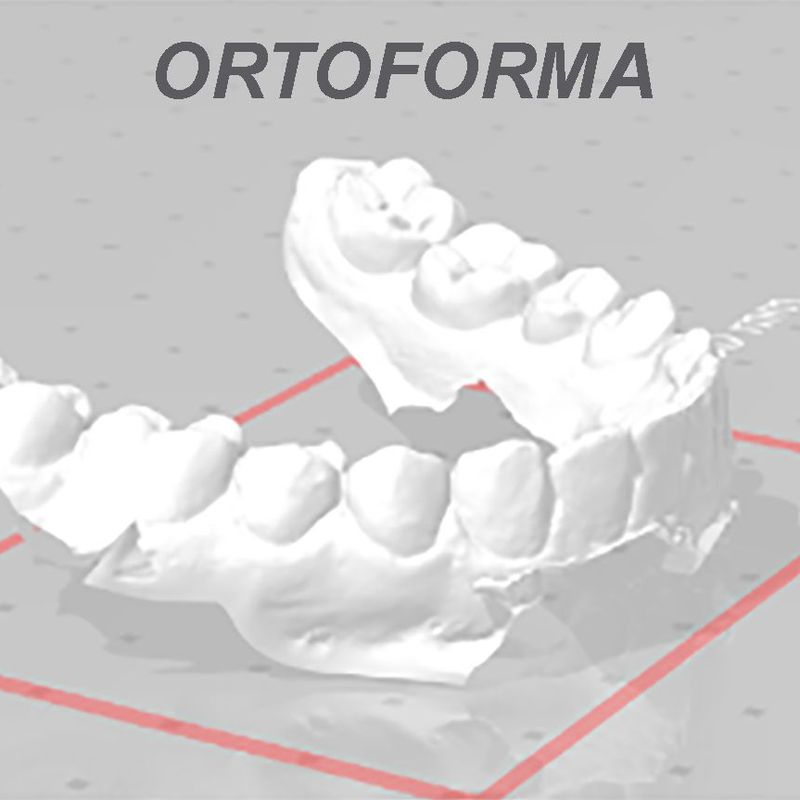 Área de diseño CAD/CAM: Productos de Ortoforma